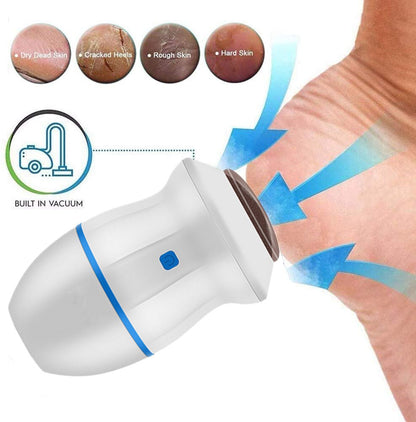 Electric Callus Remover