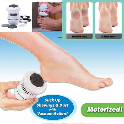 Electric Callus Remover